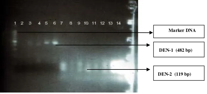 Gambar 2 menunjukkan hasil RT-PCR penderita akut DD/DBD. 