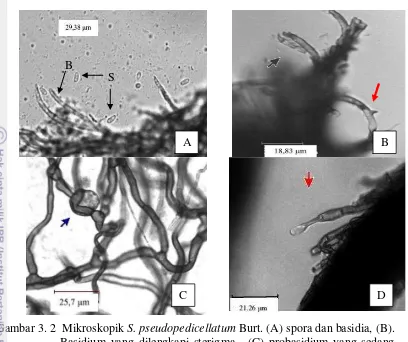 Gambar 3. 2  Mikroskopik S. pseudopedicellatum Burt. (A) spora dan basidia, (B). 