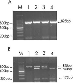 Figure 2. BsmI restriction patterns of various genotype. A. PCR product before treatment with restriction enzyme