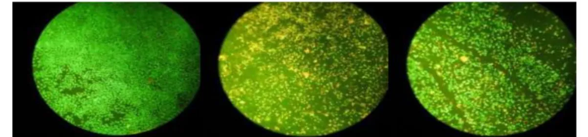 Gambar 4.1 Hasil mikroskop sel T47D sebelum pemberian ekstrak n-heksan dan  noda etydium bromide-acrydine orange (perbesaran 10 x 10) 