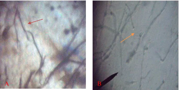 Gambar 4.3.2 Pengaruh uji antagonis terhadap miselium Aspergillus menipis dan bercabang, B: hifa mengecil dan terputus) 