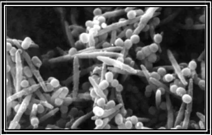 Gambar 2. Agregasi F.nucleatum (bentuk batang) dan P.gingivalis (bentuk kokus) dengan scanning electron micrograph 5