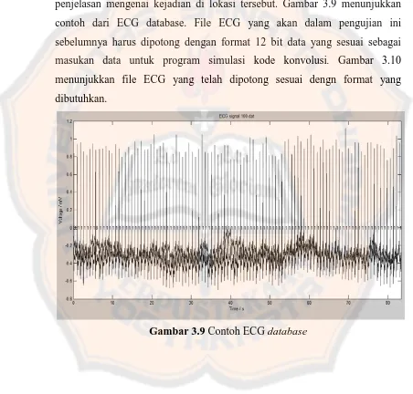 Gambar 3.9 Contoh ECG database 