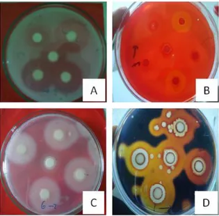 Gambar 1.    Hasil isolasi dan seleksi bakteri heterotrofik. Hasil pengujian aktivitas (A) proteolitik  