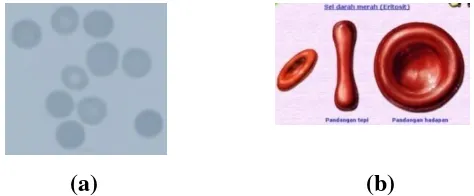 Gambar 2.1. Sel darah merah normal: (a) Sel darah merah normal, (b) Sel darah merah normal dari pandangan tepi, pandangan hadapan dan pandangan samping