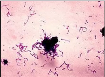 Gambar 4. Streptococcus mutans 24 