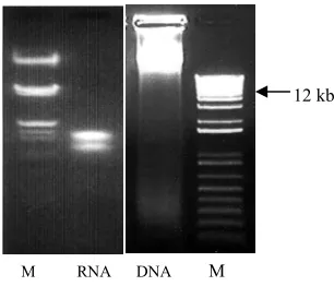 Gambar 3. PCR DNA dengan dua pasangan 