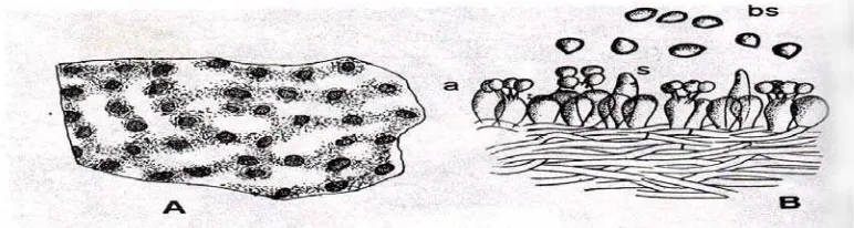 Gambar 2.A. R. lignosus (R. microporus), B. basidium (a) dengan basidiospora (bs) dan sistidium (s)