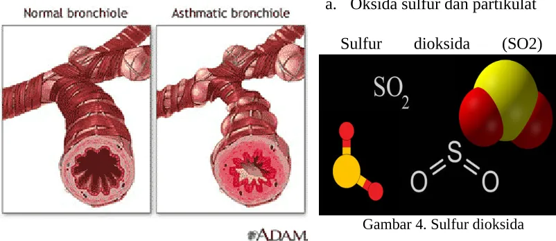 Gambar 4. Sulfur dioksida
