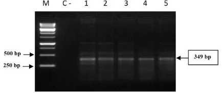 Figure 1: PCR Amplification product of cagA gene 349 bp of H. pylori. (Lane M: Ladder marker, Lane 1 to 5 biopsy samples, C- negative control) 