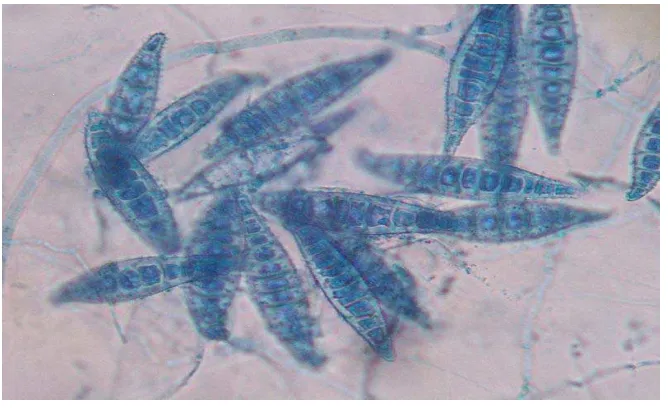 Gambar 2. Jamur Microsporum sp. 