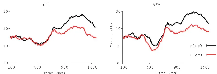 Figure 5 Topographic plots showing the scalp distribution of the long-latency slow-wave component (PSW) and changes in theamplitude of the PSW with stimulus repetition