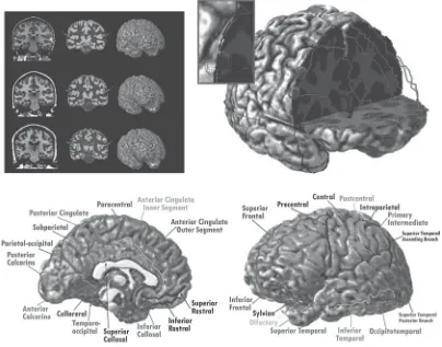 Figure 3-3 Top left,brain image data sets with the original MRI,tissue segmented images, and surface render-ings with sulcal contours shown in pink; right,subject with cutout showing tissue segmentedcoronal slice and axial slice superimposedwithin the surf