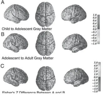Figure 3-4 Gray matter density age-effect statistical maps (left, right, and top views) show-