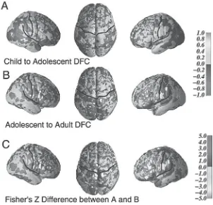Figure 3-5 DFC age-effect statistical maps (left, right, and top views) showing changes in