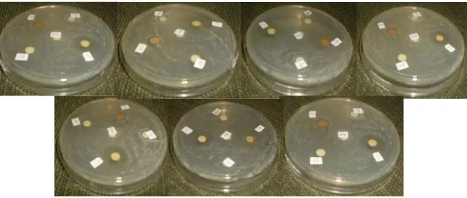 Gambar 14. Hasil percobaan uji sensitivitas disk minyak atisiri bawang putih, cengkeh, jintan hitam, etanol 96% dan aquades terhadap Staphylococcus aureus setelah 24 jam