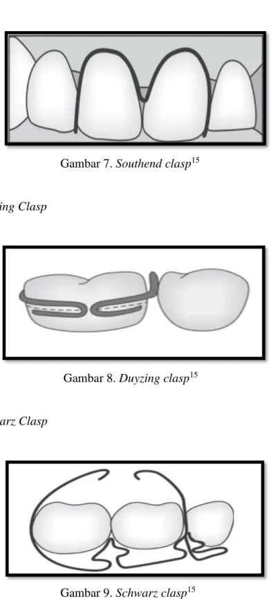 Gambar 7. Southend clasp 15 