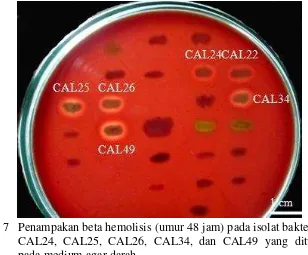 Gambar 7 Penampakan beta hemolisis (umur 48 jam) pada isolat bakteri CAL22, 