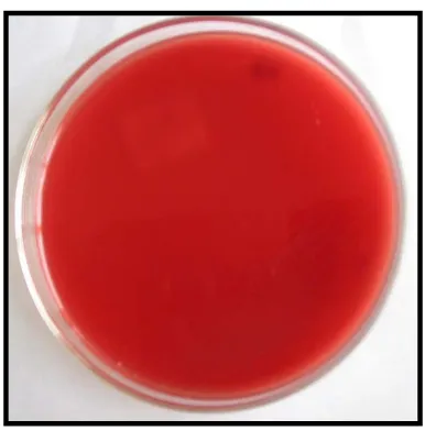 Gambar 2.11 Jenis-jenis hemolisis pada Blood Agar Plate (BAP)48 