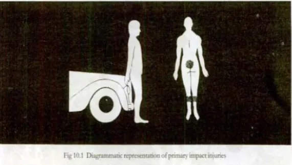 Gambar 2.1 Diagram representasi primary impact injuries (Sumber:  Guharaj, 2003) 