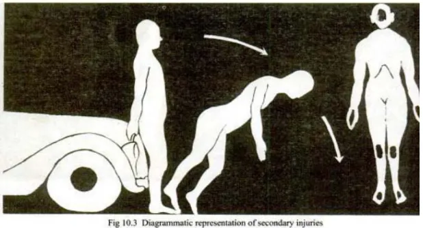 Gambar 2.3 Diagram representasi secondary injuries (Sumber: Guharaj, 2003) 