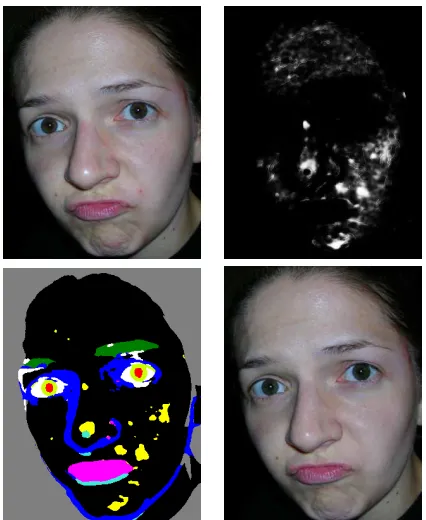 Figure 2. In this test image the blemish-detecting SVM has a strongresponse over most of the face and nose, including birthmarks andspecularities