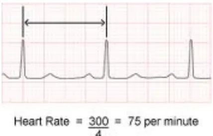 Gambar 2.4. Cara Menghitung Frekuensi Jantung dengan Metode 300  