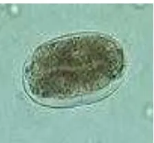 Gambar 2.2. Telur Ascaris lumbricoides17 