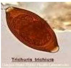 Gambar 2.4. Cacing Trichuris trichiura dewasa (Kiri : betina, Kanan : jantan)17 