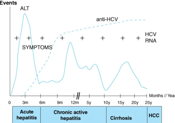 Gambar 2.6 Gambaran (Brooks, et al., 2008).  klinis dan serologi pada infeksi HCV 