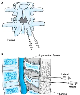 Gambar 1. Kolumna Vertebralis.3 