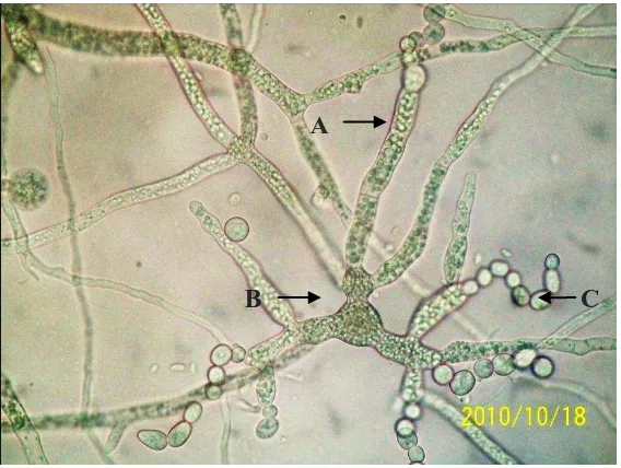 Gambar 8.  Struktur Saprolegnia sp. yang ditumbuhkan pada media SDA. (A) Hifa dengan banyak inti sel, globule minyak dan glikogen, (B) gemmae atau klamidospora dengan bentuk iregular keluar tunas terbentuk hifa baru dan (C) katenulasi klamidospora seperti rantai  