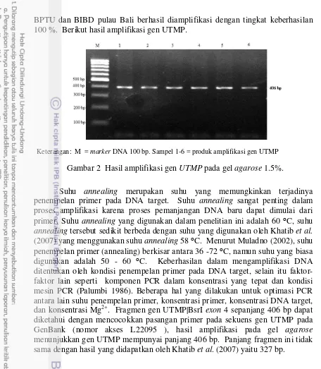 Gambar 2  Hasil amplifikasi gen UTMP pada gel agarose 1.5%. 