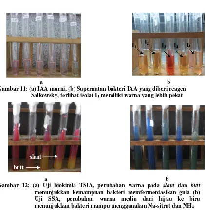 Gambar 12: (a) Uji biokimia TSIA, perubahan warna pada slant dan buttmenunjukkan kemampuan bakteri memfermentasikan gula (b) Uji SSA, perubahan warna media dari hijau ke biru menunjukkan bakteri mampu menggunakan Na-sitrat dan NH4  