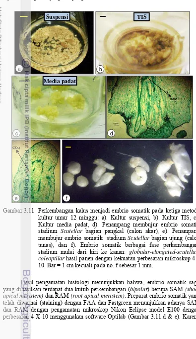 Gambar 3.11 Perkembangan kalus menjadi embrio somatik pada ketiga metode 