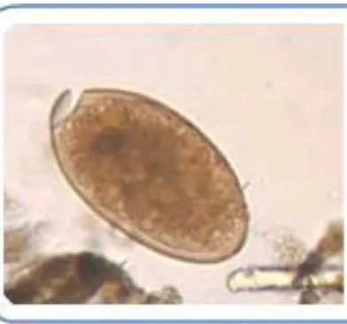 Gambar 2.1. Telur Fasciola hepatica (Sumber : CDC, 2012) 