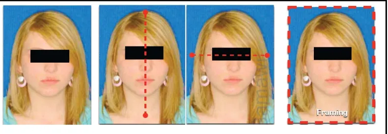 Gambar 4.    Teknik pengambilan foto frontal wajah dengan bibir dalam keadaan  istirahat