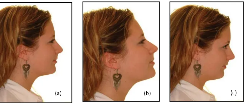 Gambar 6.  Foto lateral wajah. (a) Posisi ideal, (b) Posisi tidak benar, menginformasikan maloklusi klas III, (c) Posisi tidak benar, menginformasikan maloklusi klas II10  