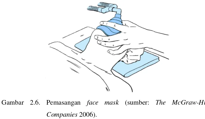 Gambar 2.6. Pemasangan face mask (sumber: The McGraw-Hill 