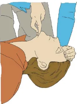 Gambar 2.1. Head-tilt, chin-lift maneuver (sumber : European 