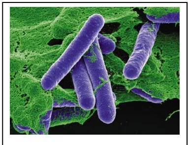 Gambar 3. Bakteri Clostridium botulinum 