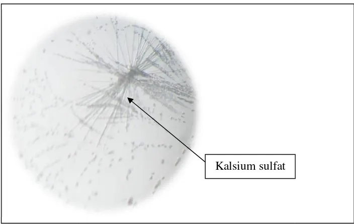 Gambar 5. 5. Gambar Kristal Kalsium sulfat (Perbesaran 10xn 10x10)