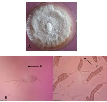 Gambar 4. Karakteristik  Pestalotia theae Sawada., A. Koloni fungi umur 14 hari pada media PDA; B