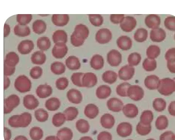 Gambar 7.3 Sel darah 