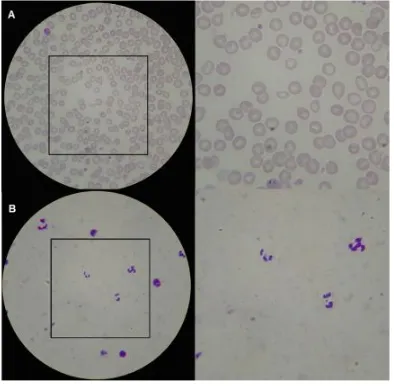 Fig. 8. Focused image obtained using the µSmartScope, and respective central squareresulting from focus region selection: (A) Thin blood smear; (B) Thick blood smear.