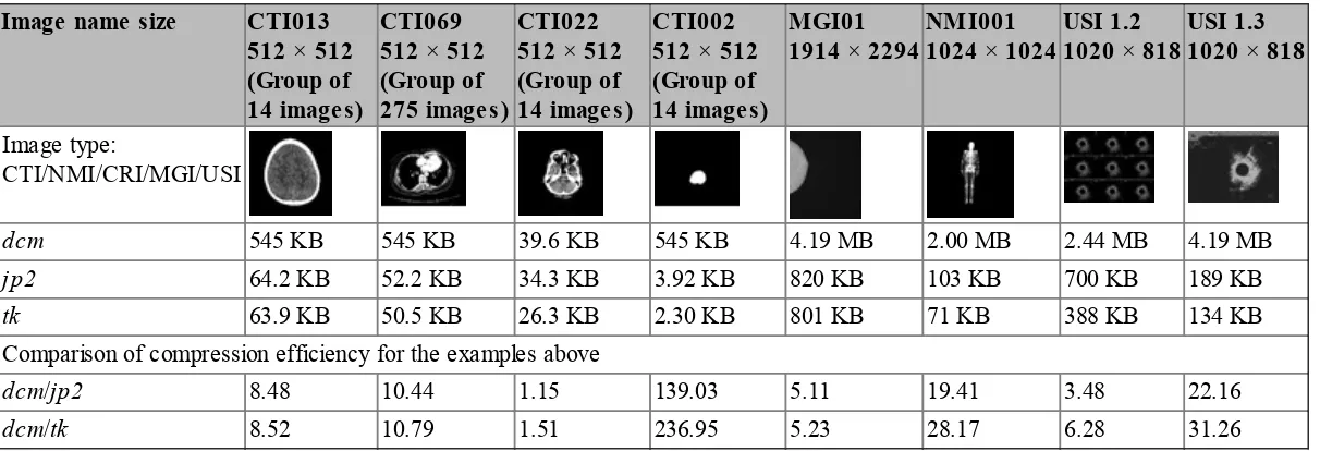 Table 1.1 Results for the lossless compression of various classes of medical images