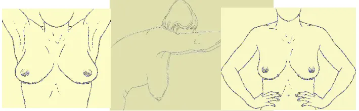 Gambar –ke Atas, Tangan di Pinggang, Membungkuk 4 a, b dan c. Tampilan Payudara (kiri ke kanan): Lengan 