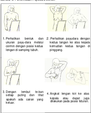 Gambar 8. Pemeriksaan Payudara Sendiri 