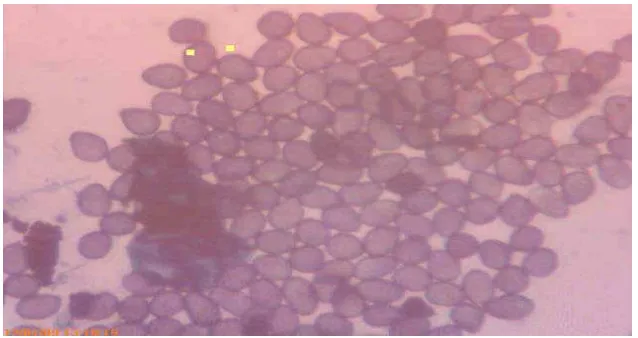 Gambar 1. Urediospora Phakopsora  pachyrizi,  penyebab penyakit karat daun kedelai (10x)  