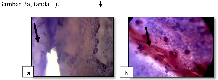 Gambar 2. Gejala serangan  Foc pada permukaan daun  (a), gejala pada pangkal batang (b), dan akar busuk (c)